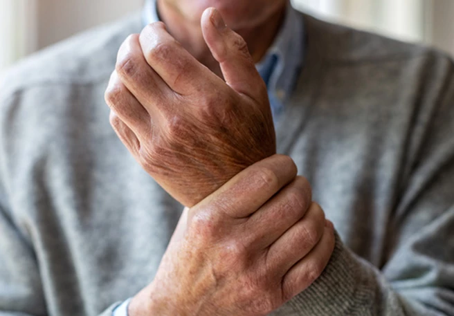 STADA and Alvotech broaden European patients’ options by launching a high-concentration, citrate-free adalimumab